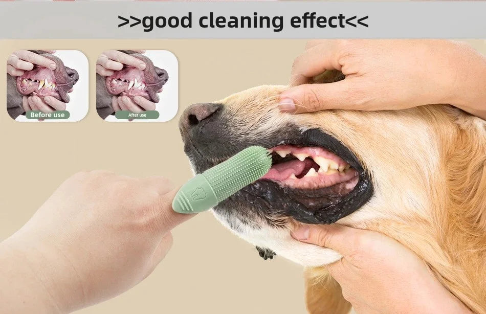 Finger Toothbrush Set