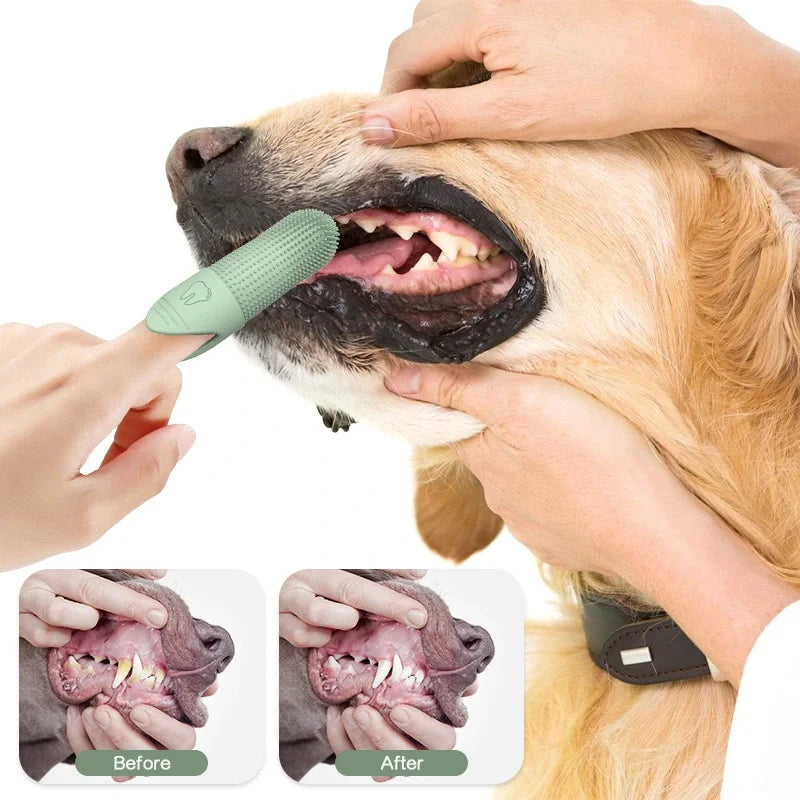 Finger Toothbrush Set